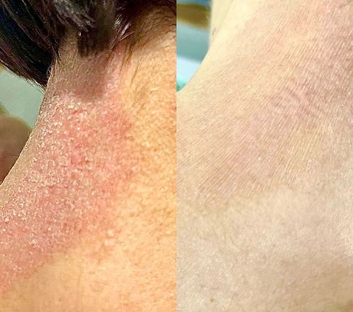 Derma Douce Plus 15% d'urée